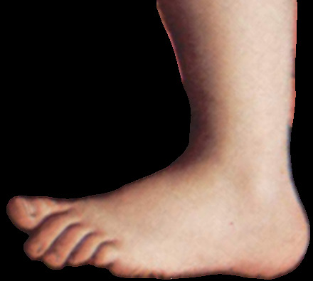 pythonfoot.jpg